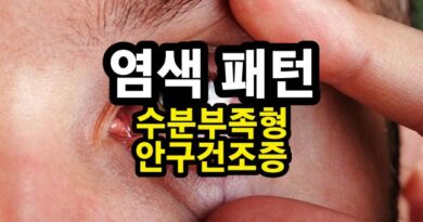 수분부족형 안구건조증 (눈물막 패턴 Part.03)