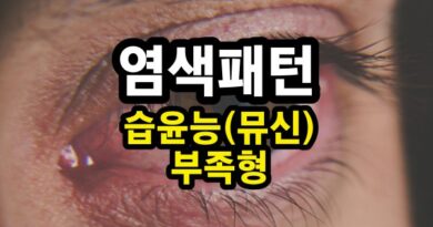 습윤능 부족형 안구건조증(염색 패턴 Part.05)