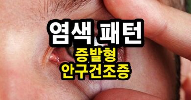 증발형 안구건조증(염색 패턴 Part. 04)