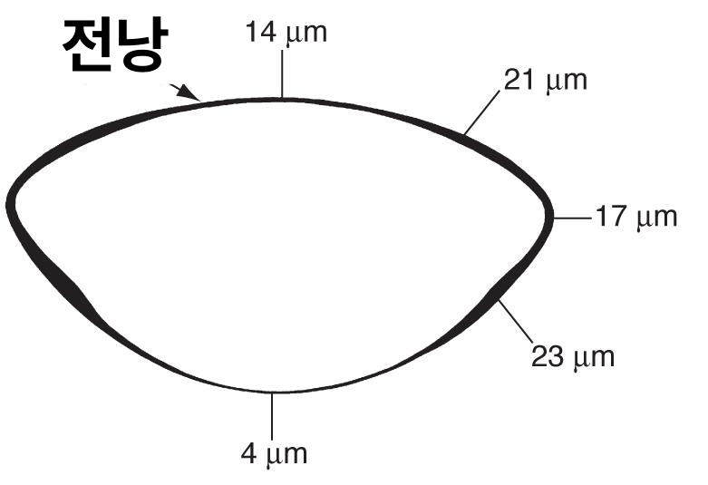 딱딱한 백내장 술기 part1 - 전낭염색