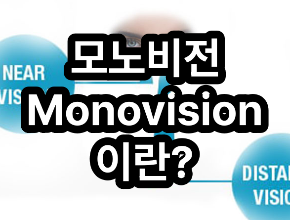 모노비전(Monovision) 기본 개념