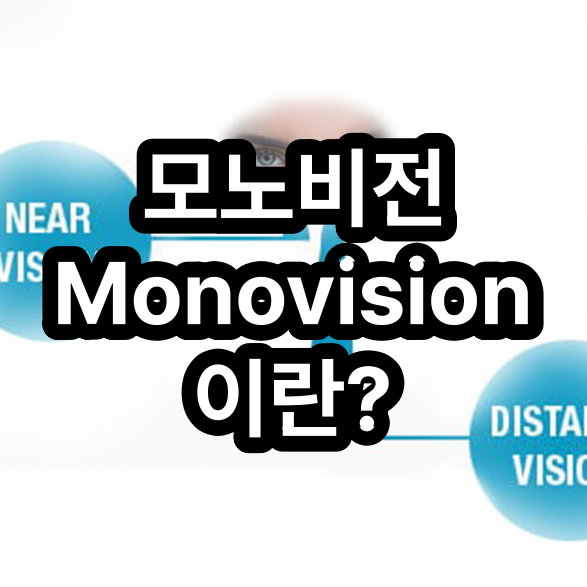 모노비전(Monovision) 기본 개념