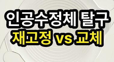 인공수정체 아탈구 접근법: 재고정 vs 교체