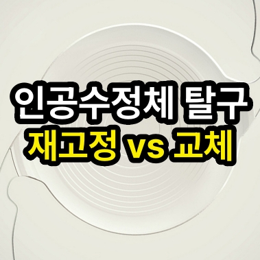 인공수정체 아탈구 접근법: 재고정 vs 교체