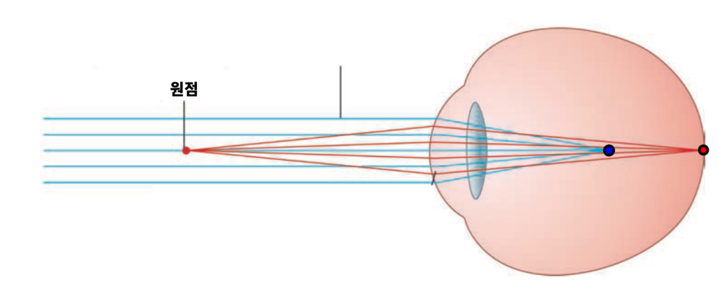 난시 이해를 위한 광학, 그리고 교정 원리 - 1