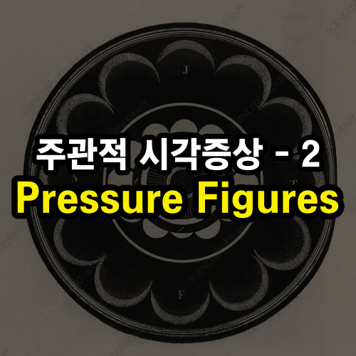 주관적 시각 증상 2 – 압박으로 인한 빛 무늬 (Pressure Figures)