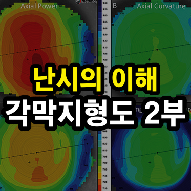 각막지형도 기본-2: 다양한 지도 해석하기